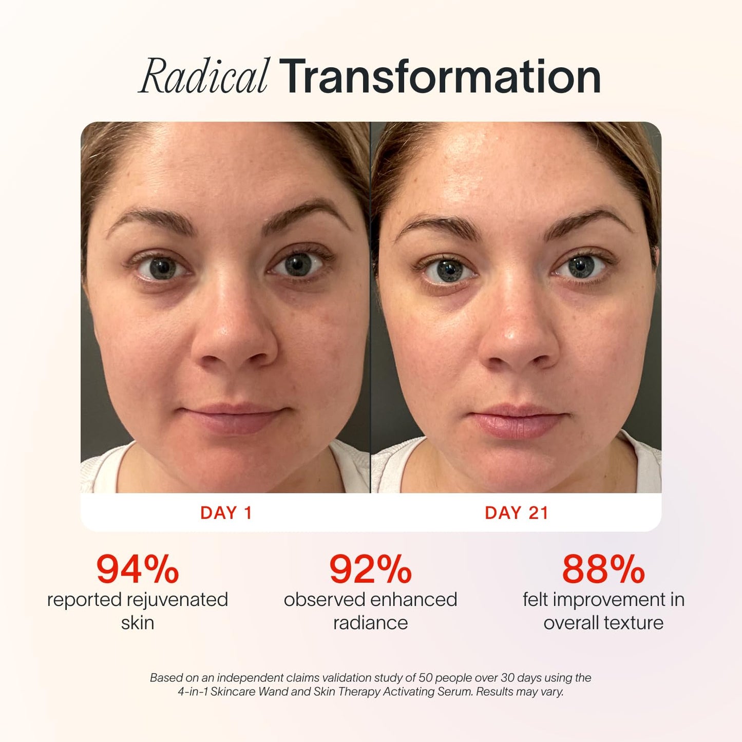 Solawave Paquete de suero de terapia facial 4 en 1 con varita de luz.