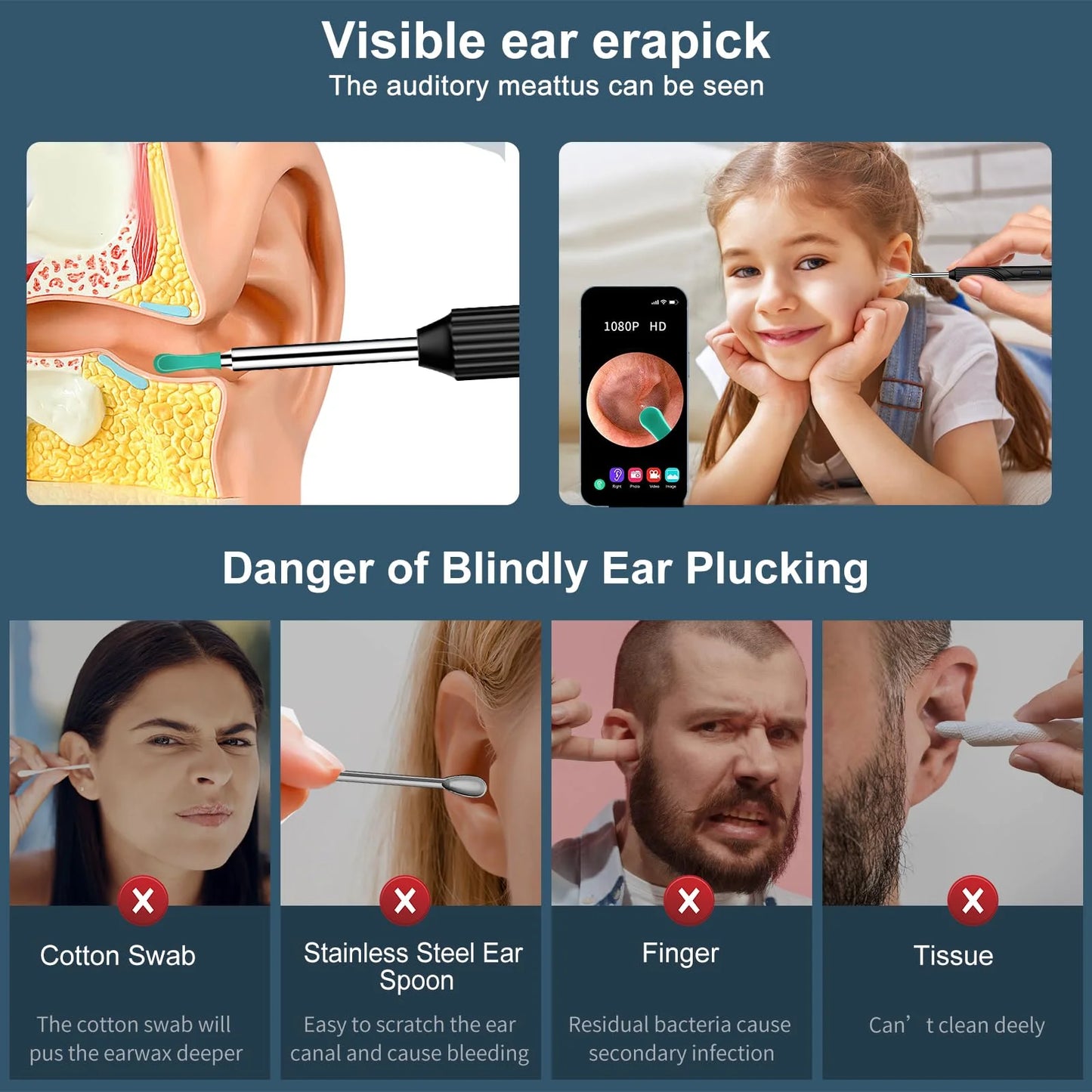 Kit de eliminación de cerumen con cámara, WiFi, 7pcs limpieza.