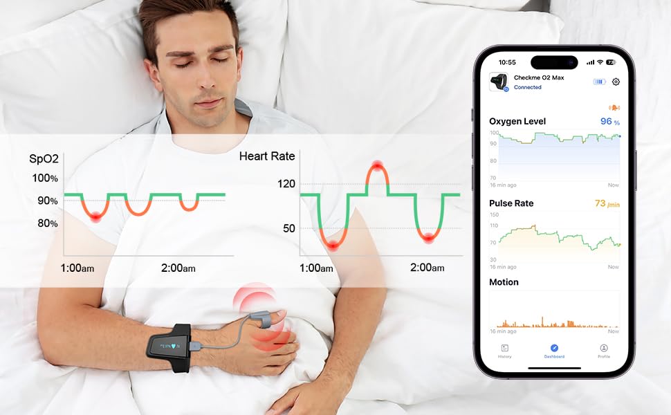 Medidor de oxígeno Bluetooth para la salud,MONITOR DE OXIGENO.
