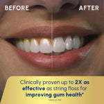 Irrigador Dental Waterpik Inalámbrico Recargable