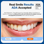Cepillo de dientes Bitvae Daily D2, eléctrico y ultrasónico, Recargable.