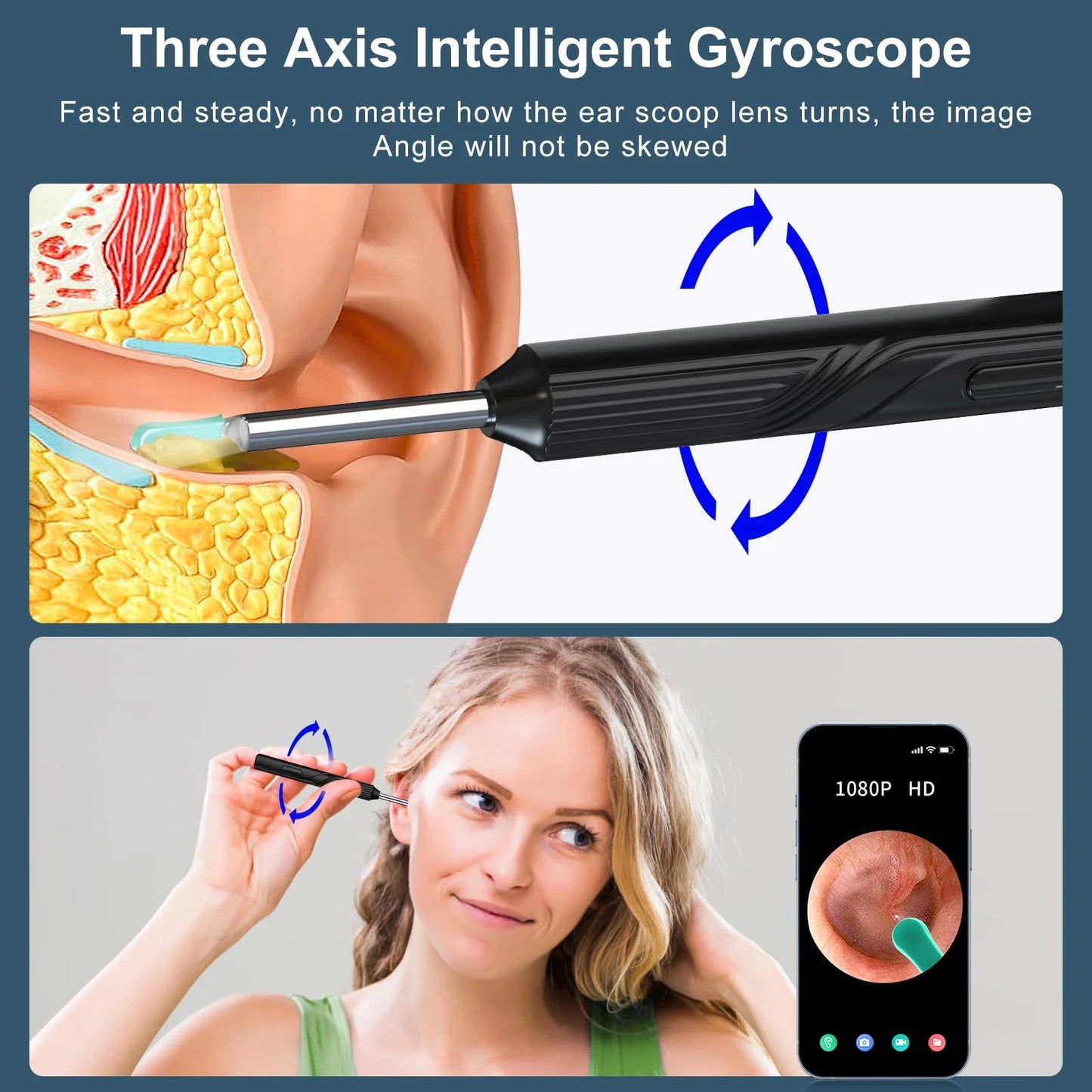Kit de eliminación de cerumen con cámara, WiFi, 7pcs limpieza.